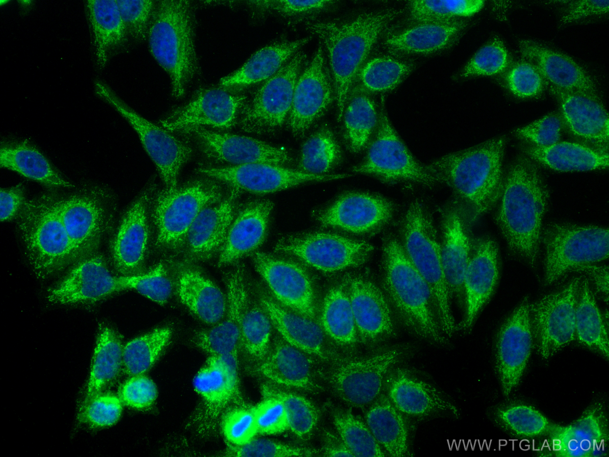 IF Staining of HepG2 using 13640-1-AP