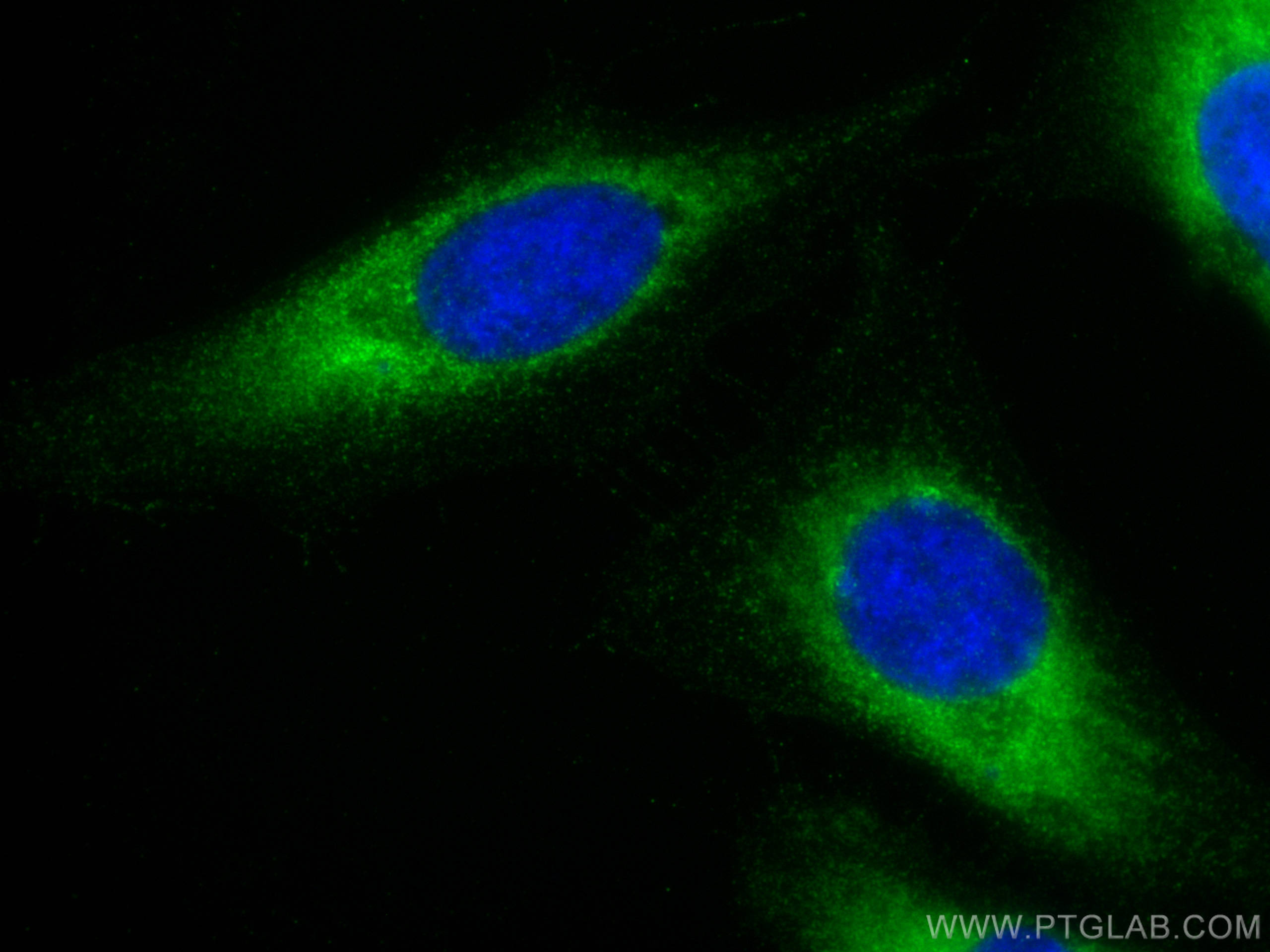 IF Staining of HeLa using 23854-1-AP