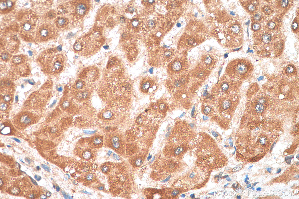 IHC staining of human liver using 30028-1-AP