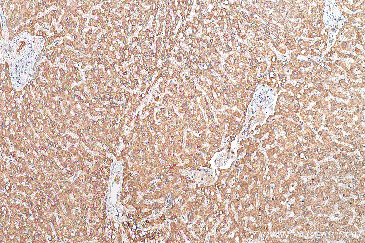 IHC staining of human liver using 30028-1-AP