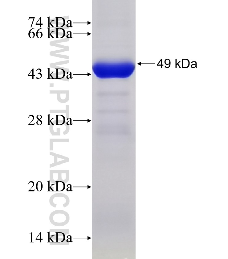 BCKDHB fusion protein Ag33802 SDS-PAGE