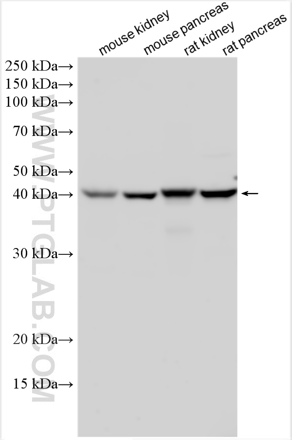 WB analysis using 15718-1-AP (same clone as 15718-1-PBS)