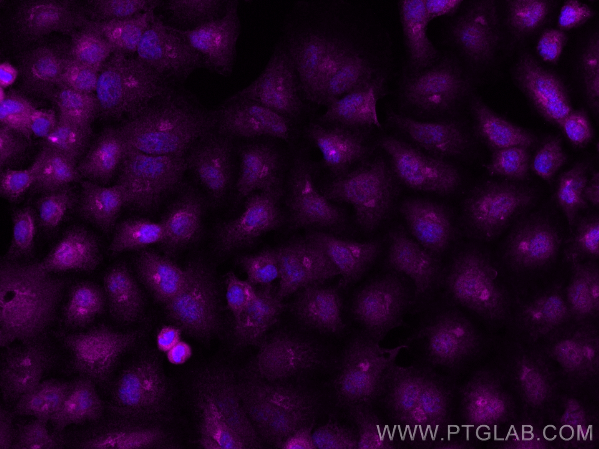 IF Staining of A549 using CL647-50180