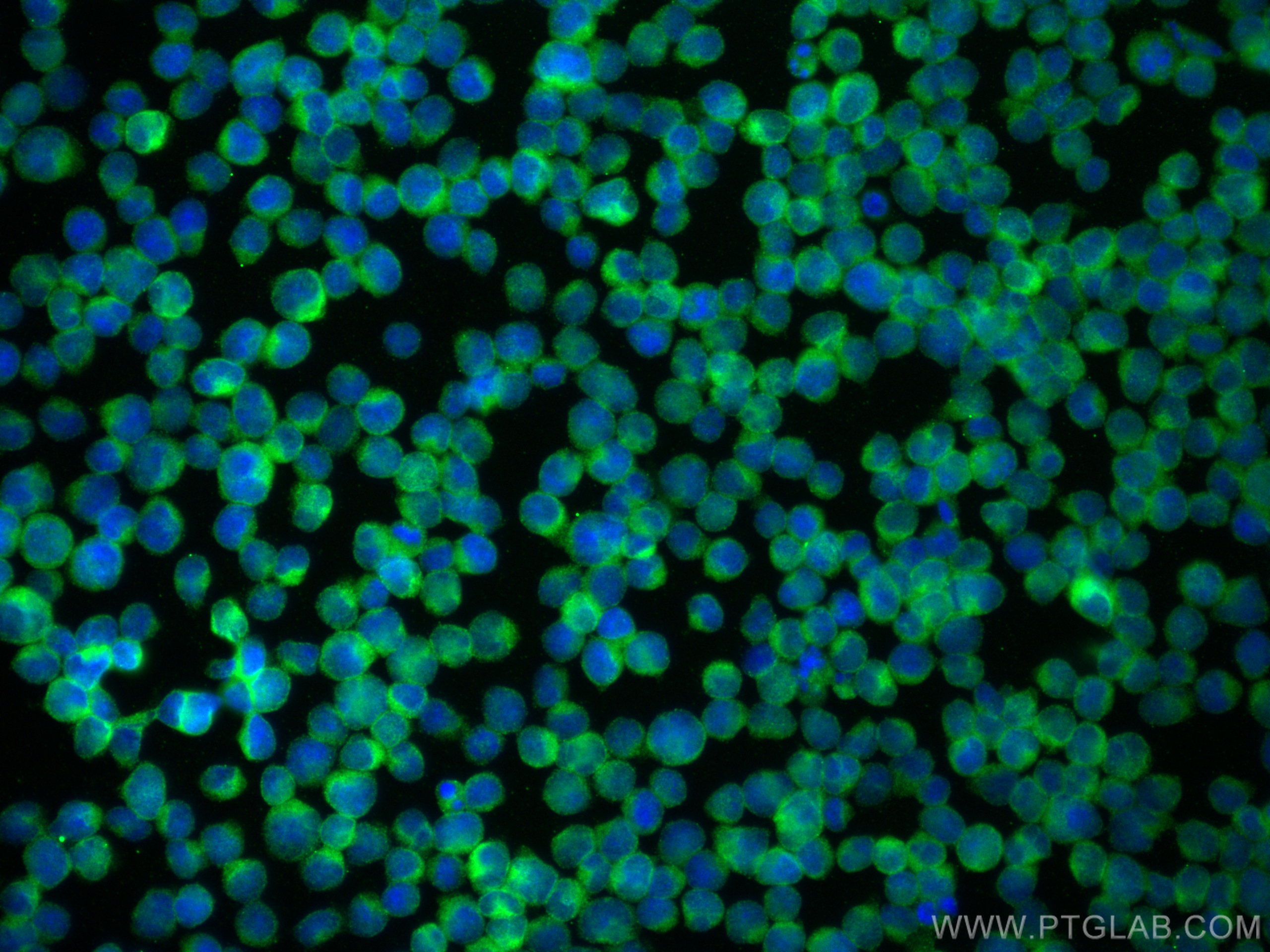 IF Staining of Jurkat using 12789-1-AP