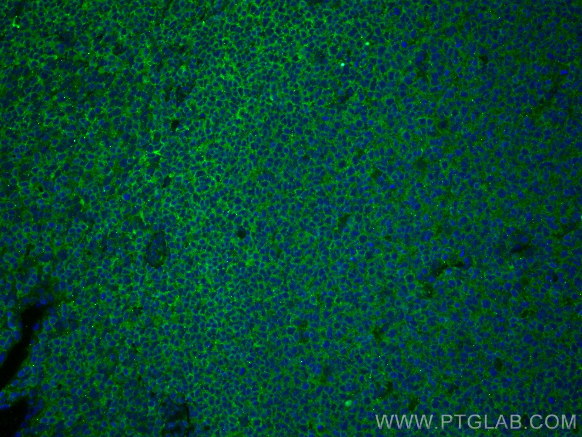 IF Staining of human tonsillitis using 80313-1-RR (same clone as 80313-1-PBS)