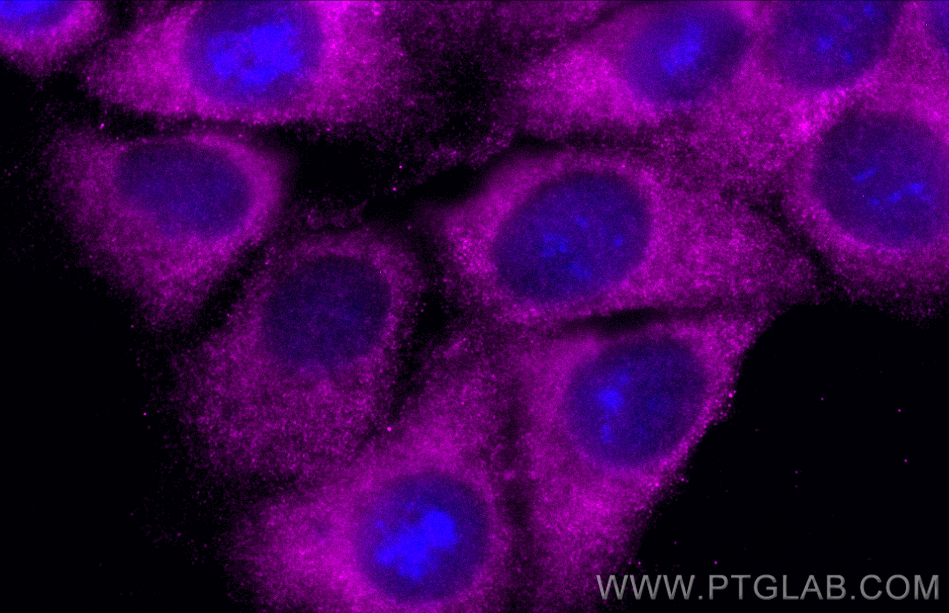 IF Staining of MCF-7 using CL647-60178