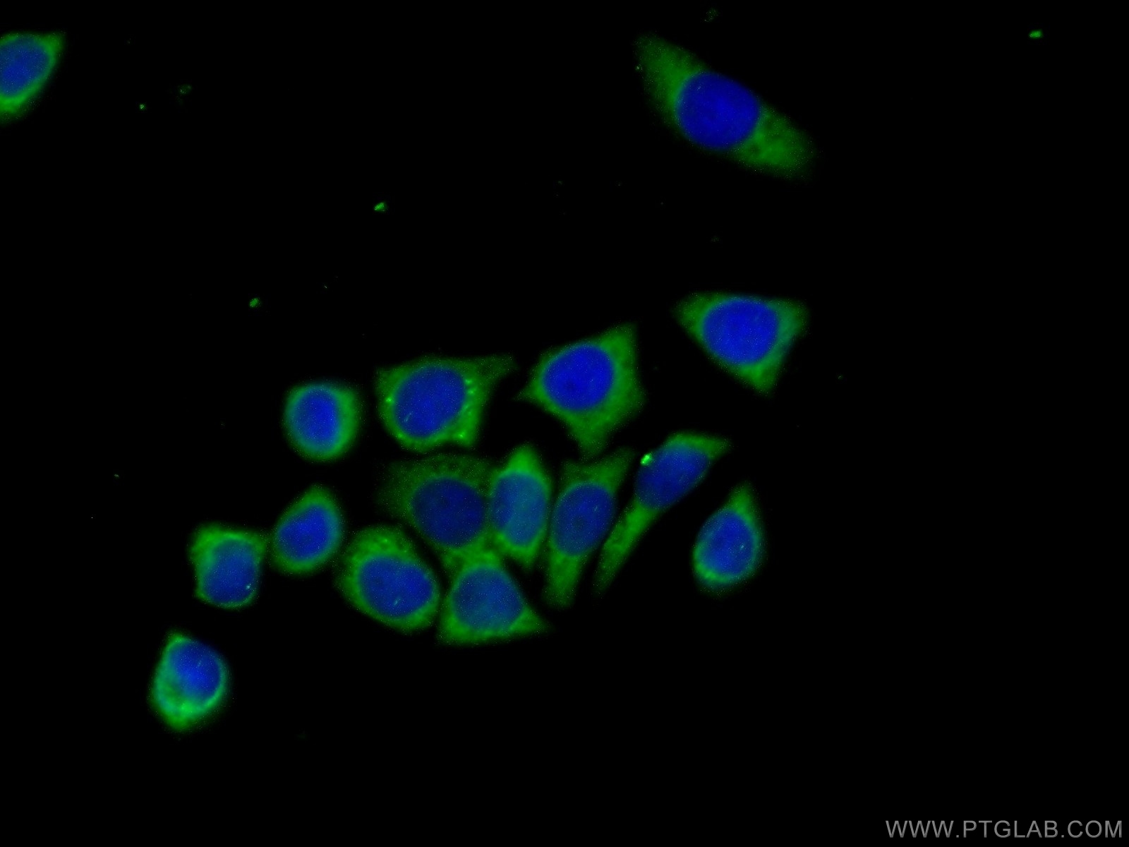 IF Staining of PC-3 using 21969-1-AP