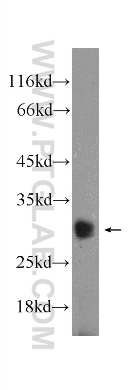 WB analysis of PC-3 using 21969-1-AP