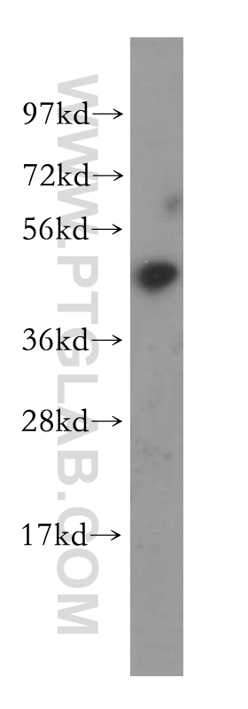 WB analysis of HeLa using 11740-1-AP