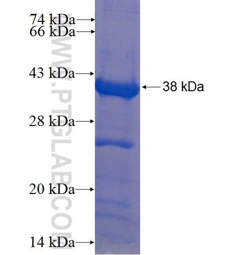 BCL7B fusion protein Ag22892 SDS-PAGE