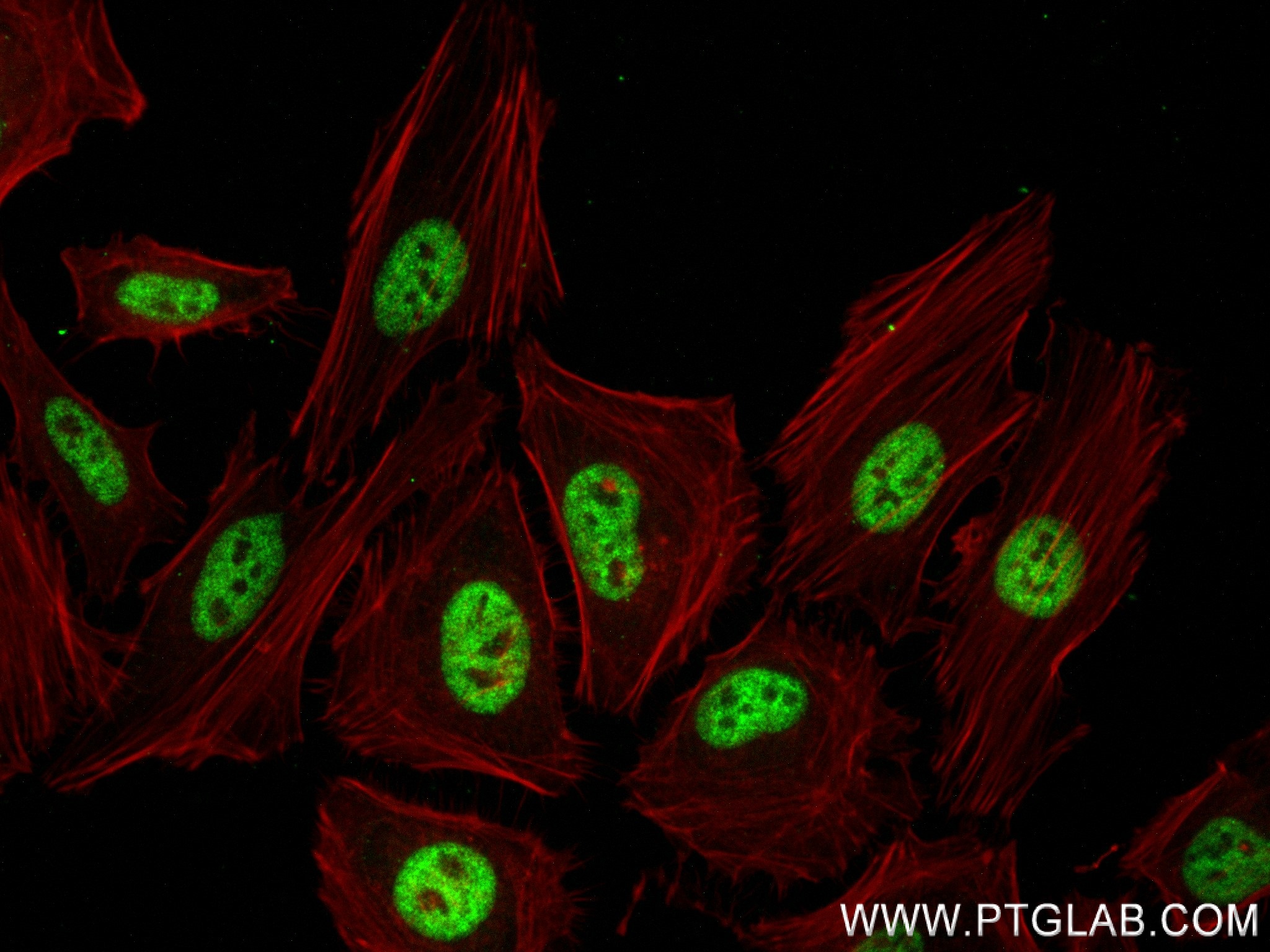 IF Staining of HeLa using 83760-3-RR