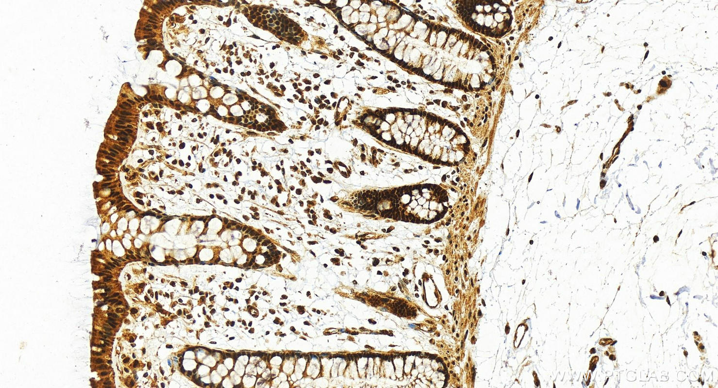 IHC staining of human colon using 26809-1-AP