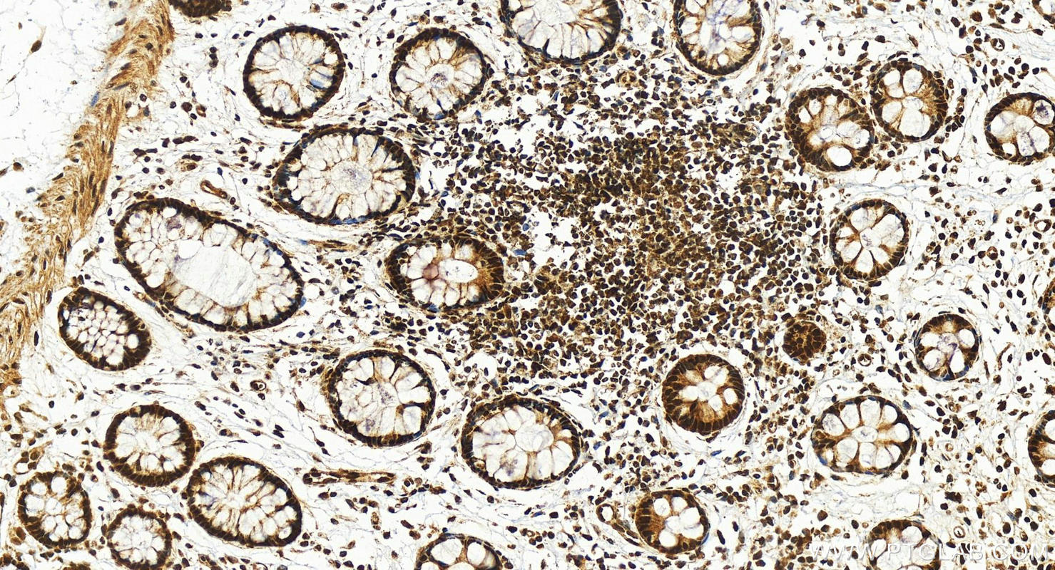 IHC staining of human colon using 26809-1-AP