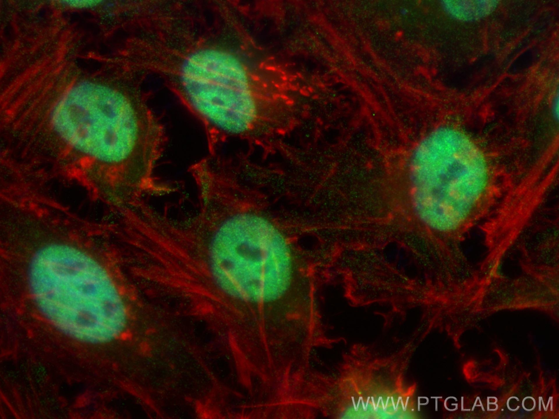 IF Staining of HeLa using 67860-1-Ig (same clone as 67860-1-PBS)