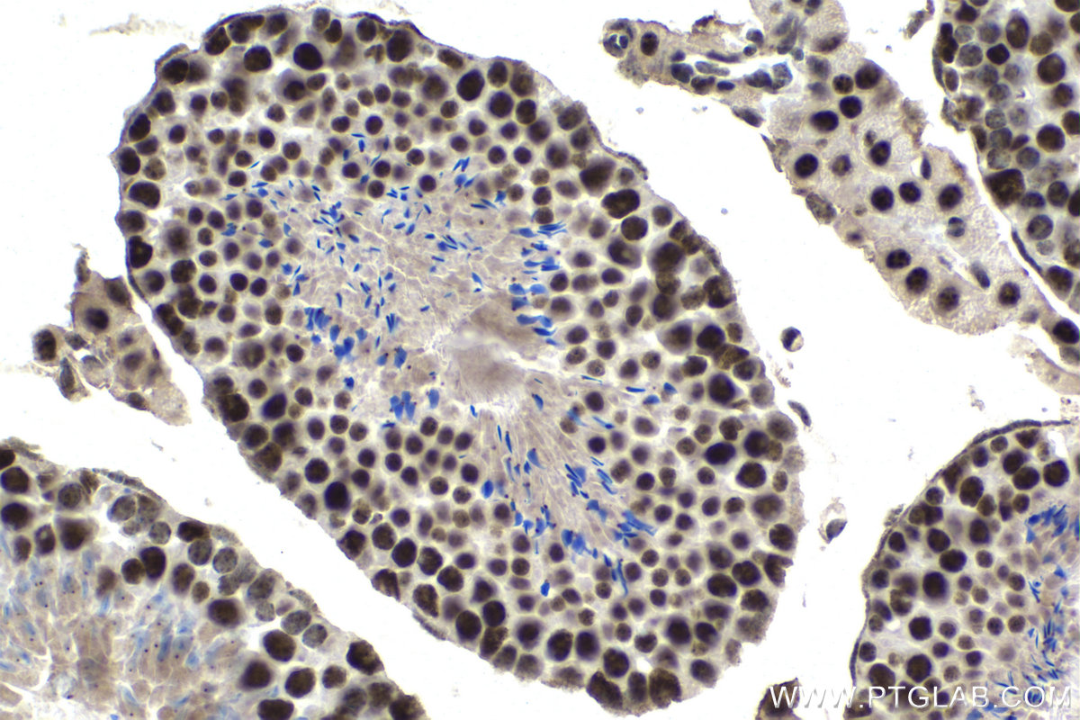 IHC staining of mouse testis using 67860-1-Ig