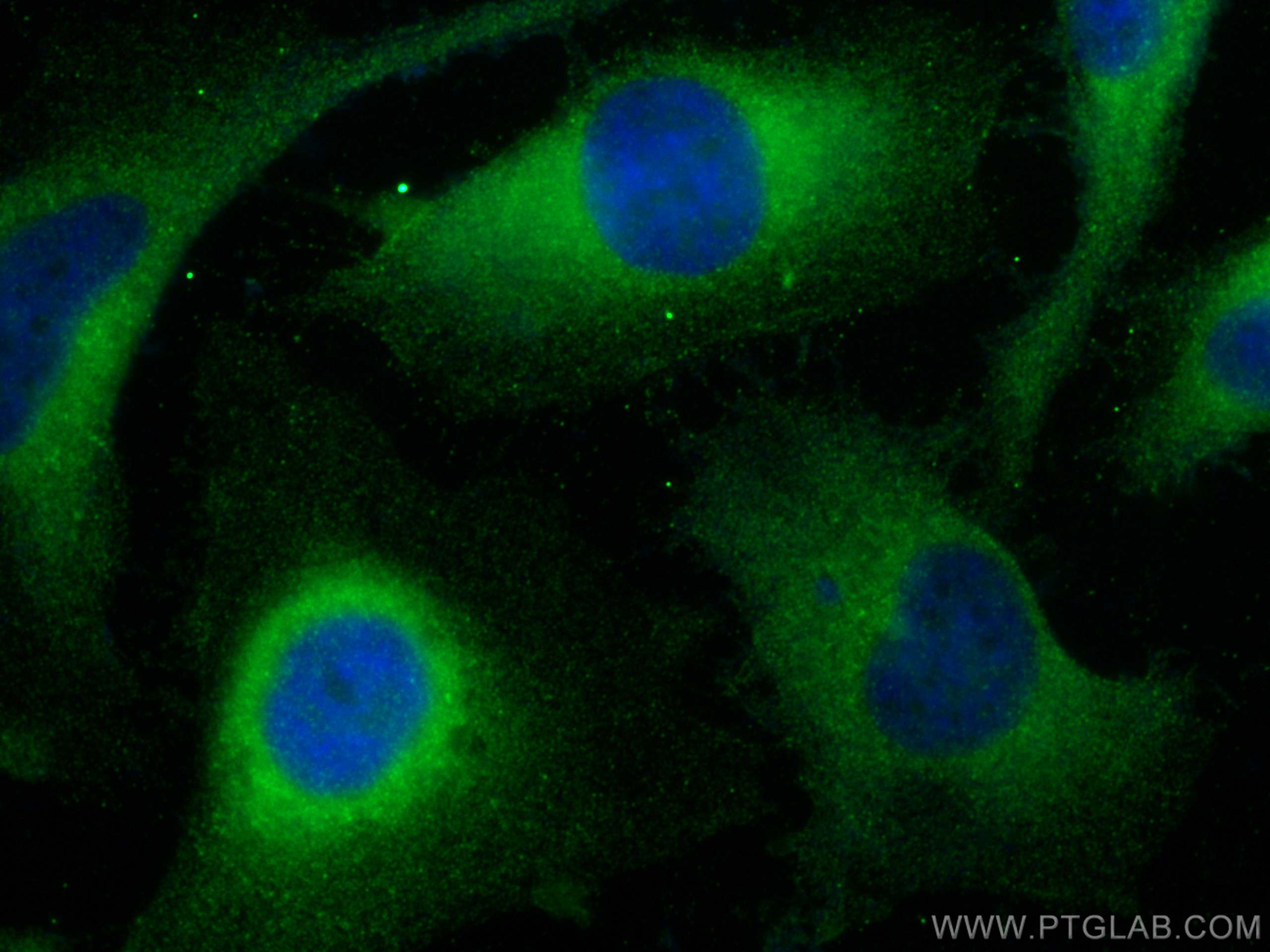 IF Staining of HeLa using 22585-1-AP