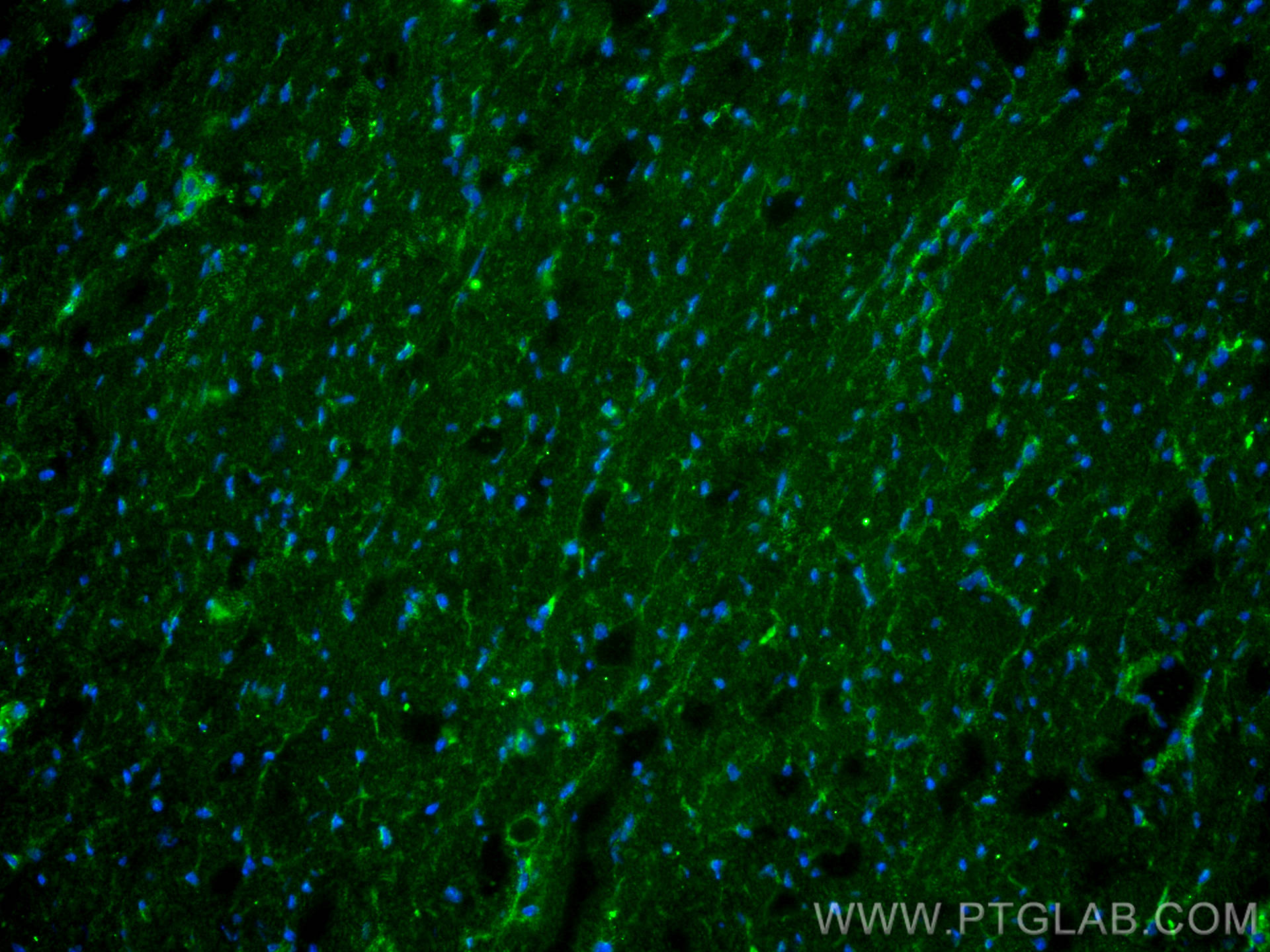 IF Staining of mouse heart using 11306-1-AP