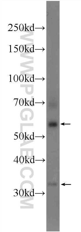 WB analysis of mouse testis using 24711-1-AP