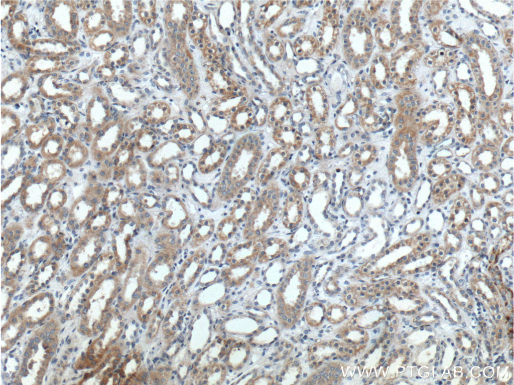 IHC staining of human kidney using 14134-1-AP