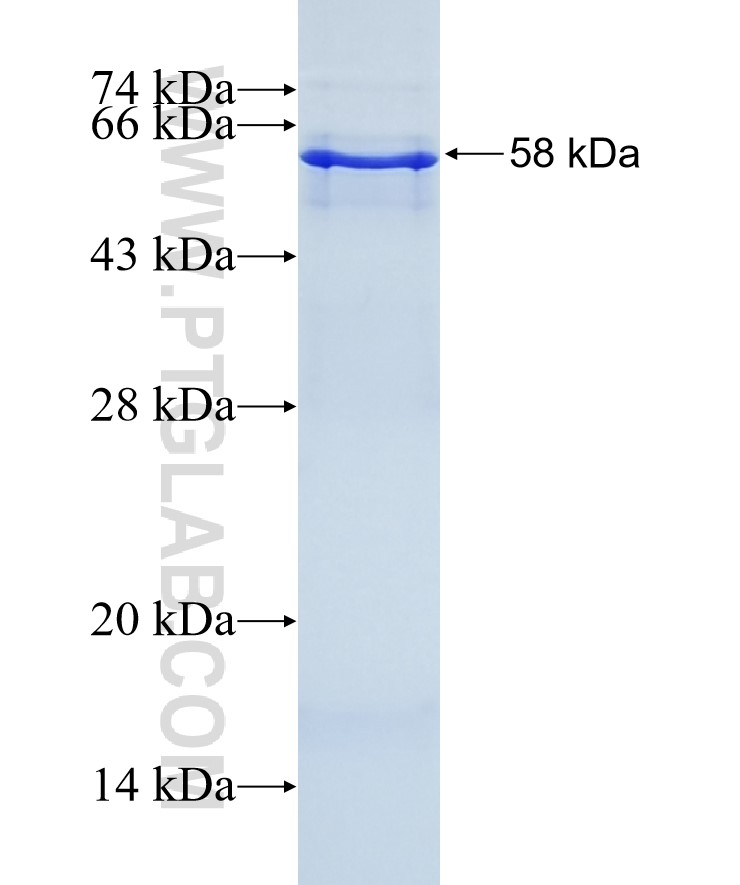 BETA-TRCP,BTRC fusion protein Ag28739 SDS-PAGE