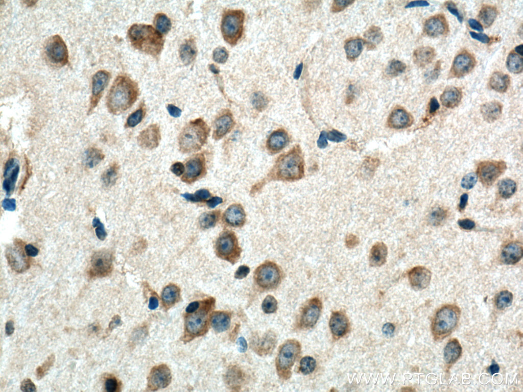 IHC staining of mouse brain using 25281-1-AP