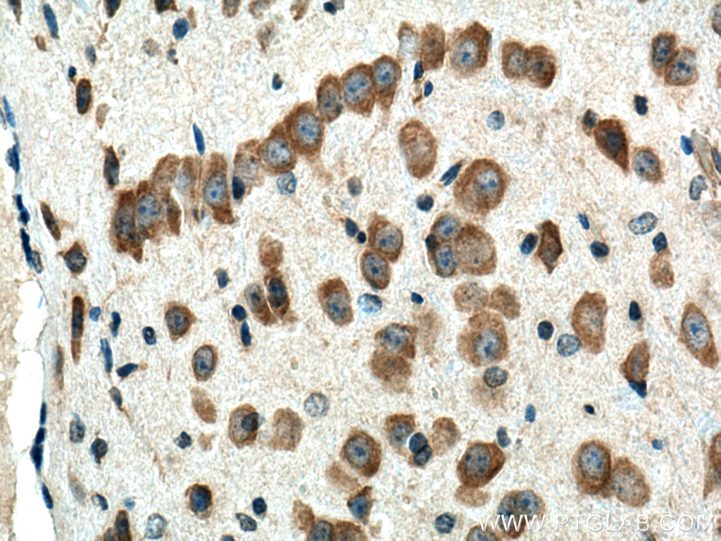 IHC staining of mouse brain using 25281-1-AP