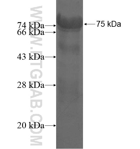 BFSP1 fusion protein Ag11591 SDS-PAGE