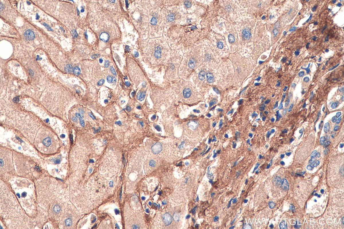 IHC staining of human liver using 16409-1-AP