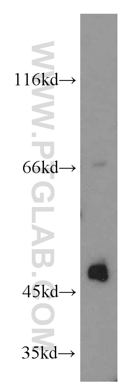 Biglycan Polyclonal antibody