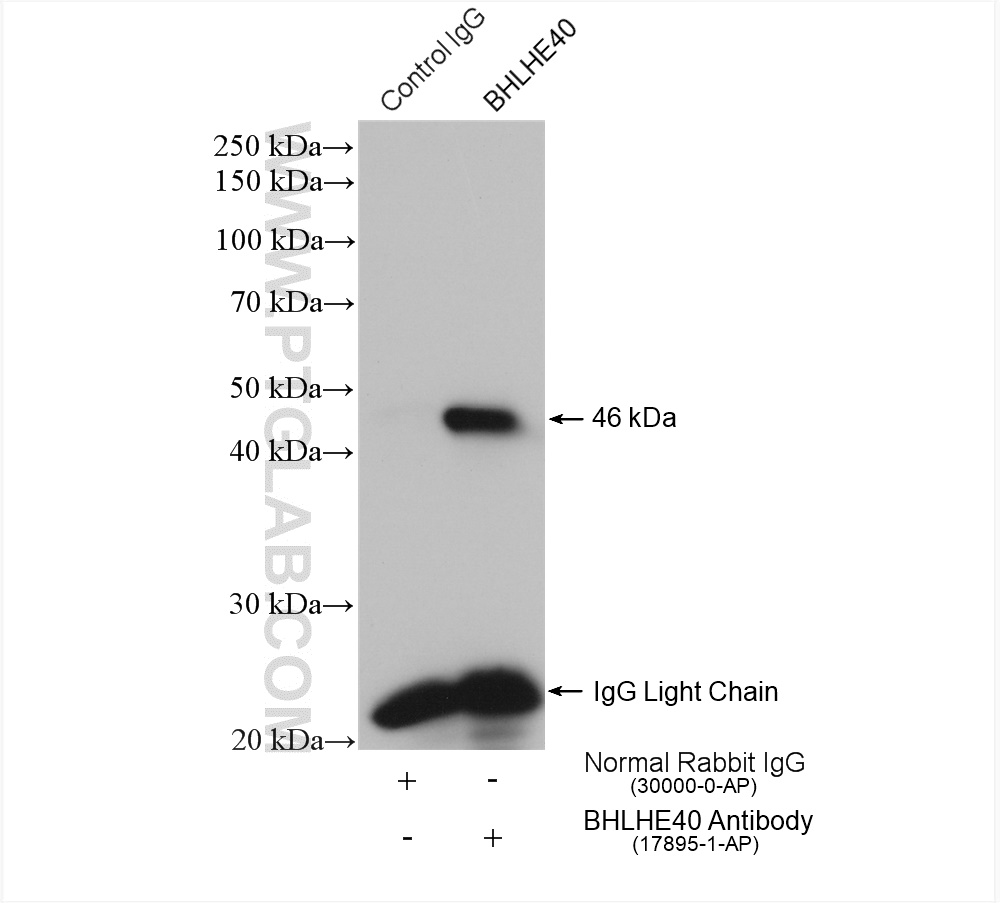 IP experiment of HeLa using 17895-1-AP (same clone as 17895-1-PBS)