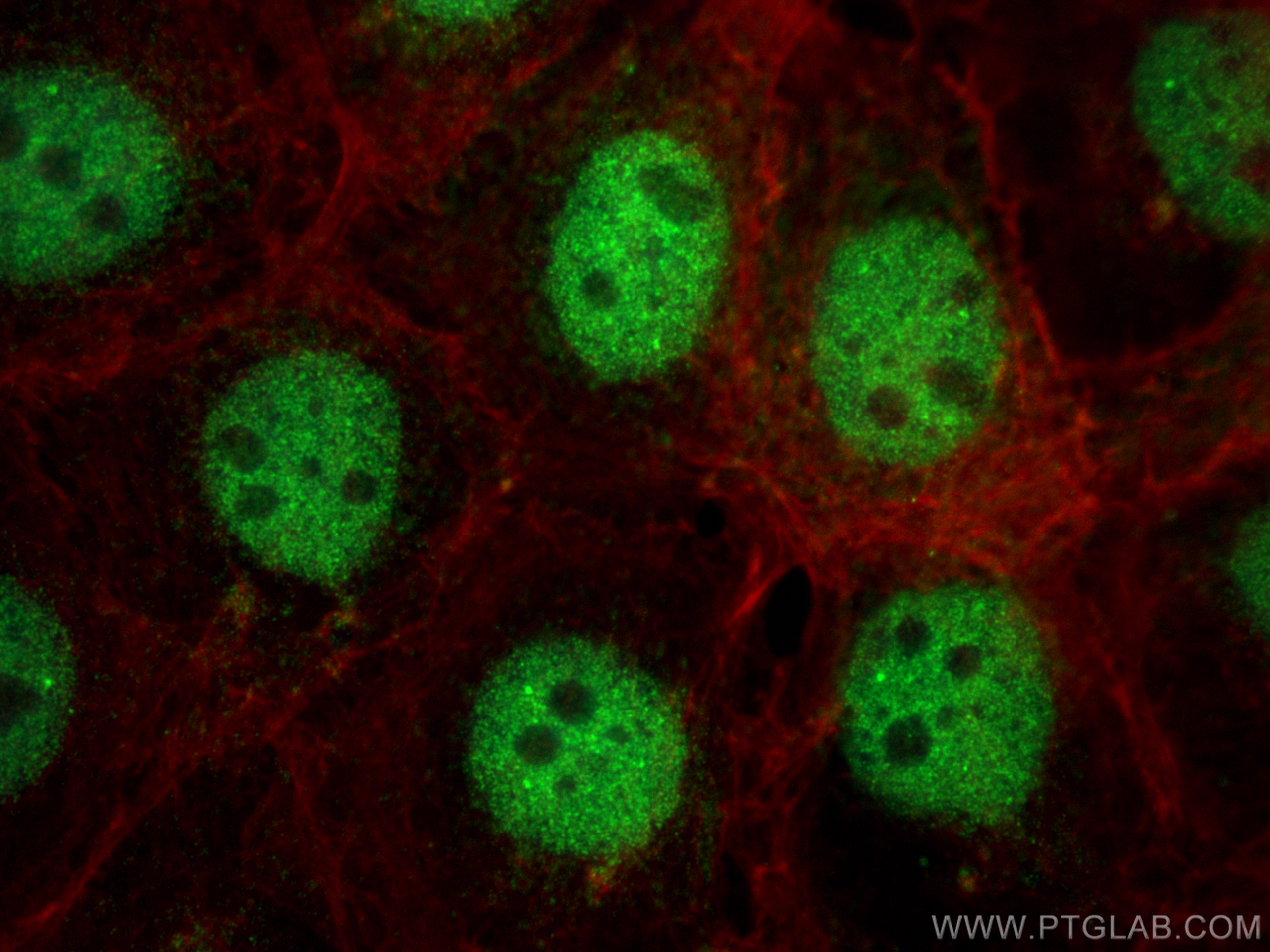 IF Staining of A431 using 12688-1-AP