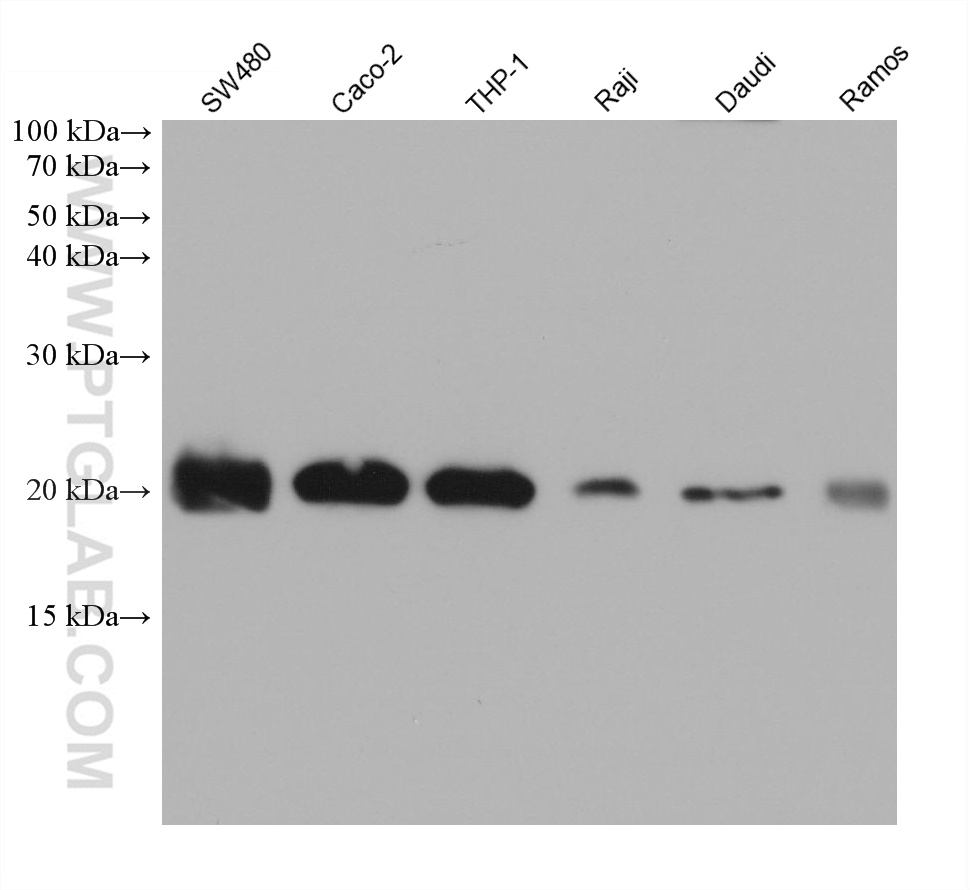 WB analysis using 68438-1-Ig