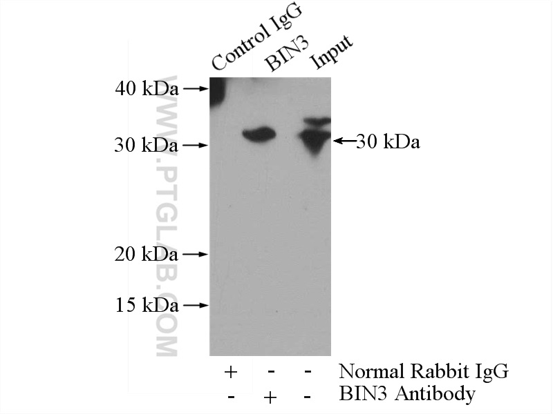 IP experiment of K-562 using 11215-1-AP