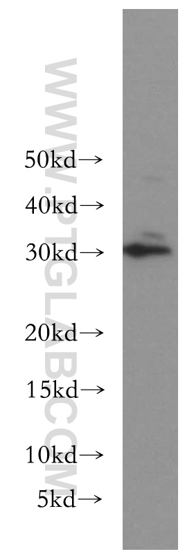 WB analysis of K-562 using 11215-1-AP