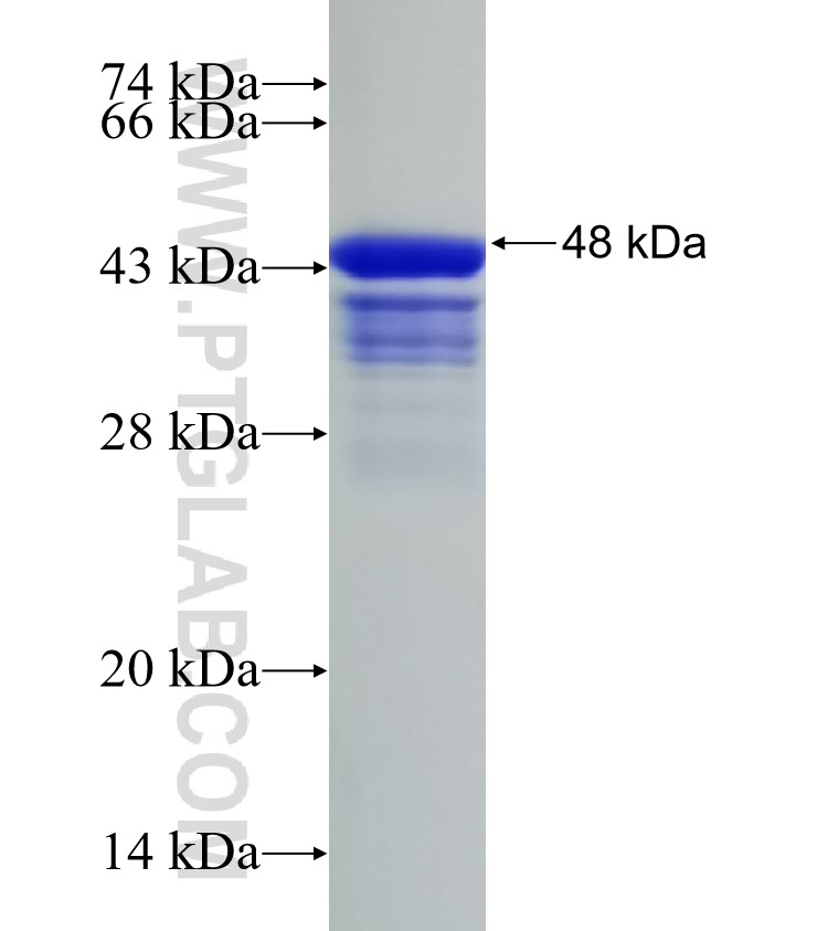 BLM fusion protein Ag32996 SDS-PAGE