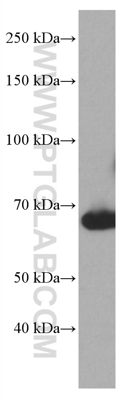 WB analysis of human spleen using 66953-1-Ig