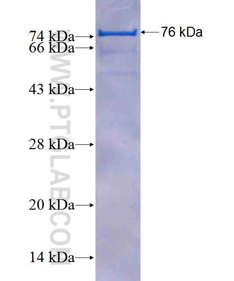 BLNK fusion protein Ag1290 SDS-PAGE