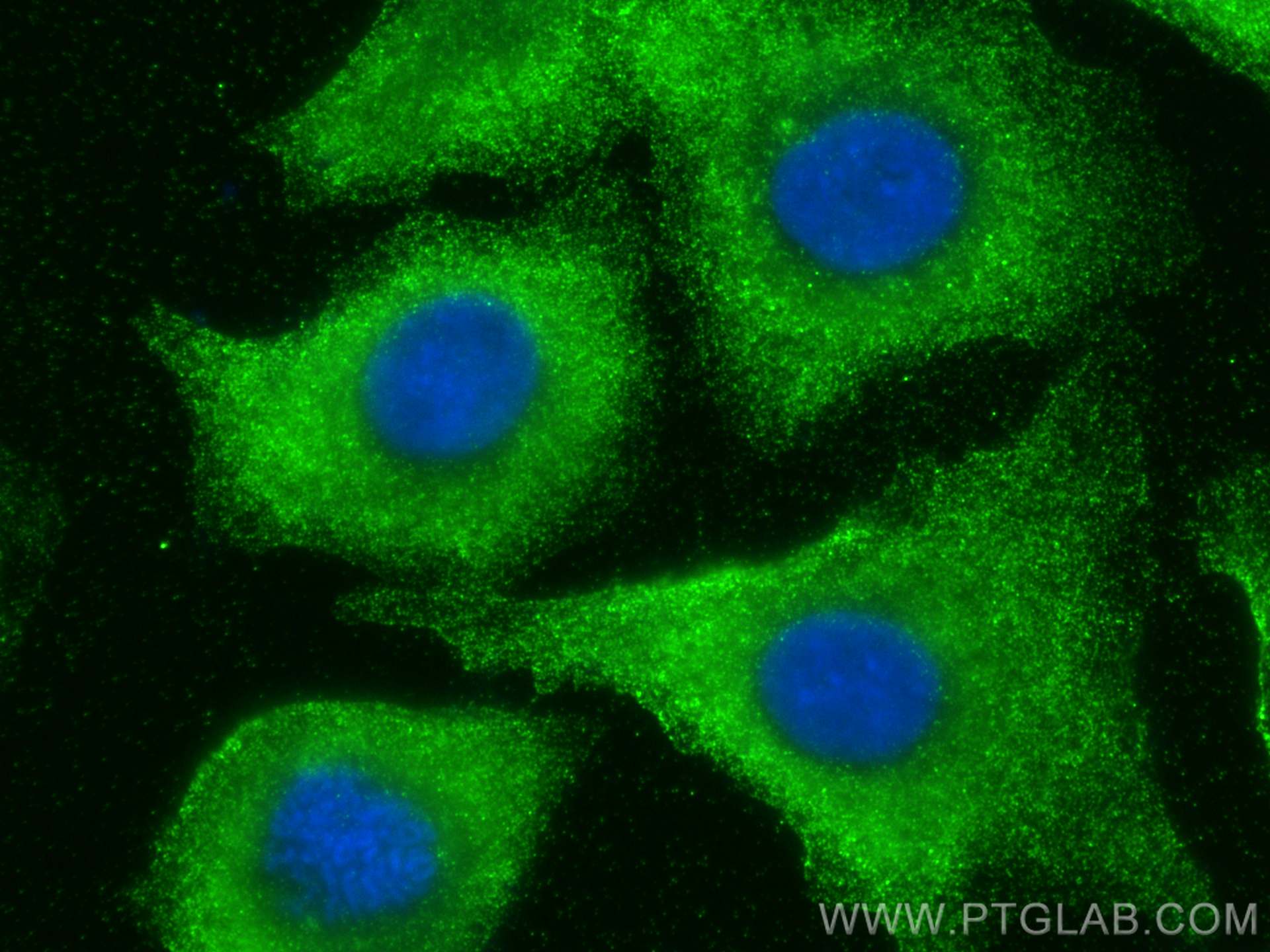 IF Staining of A549 using 68175-1-Ig