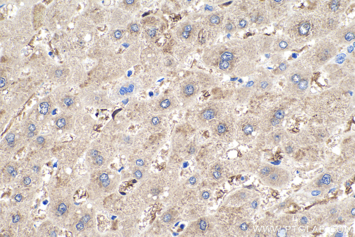 IHC staining of human liver using 17727-1-AP