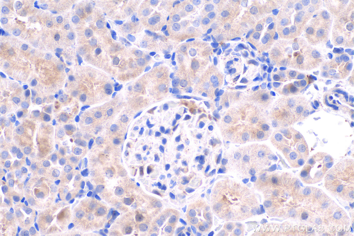 IHC staining of rat kidney using 17727-1-AP