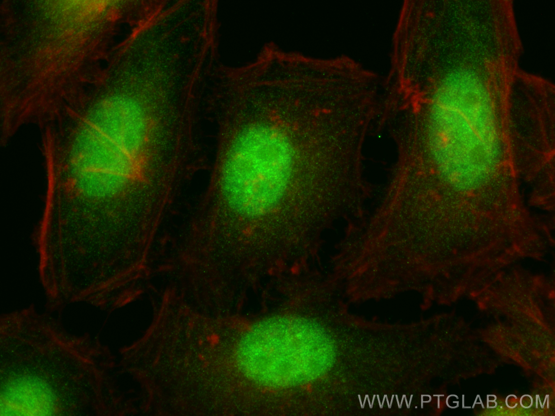 IF Staining of HeLa using 11074-2-AP