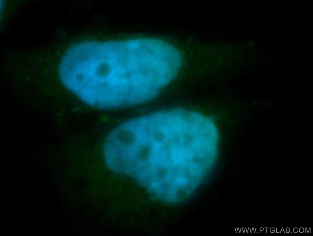 IF Staining of SH-SY5Y using 11074-2-AP