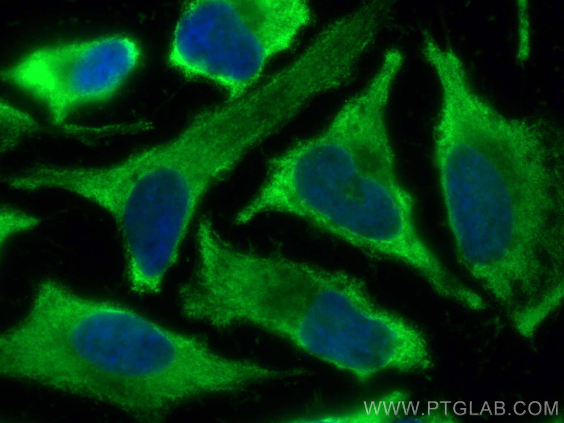 IF Staining of HeLa using CL488-60079