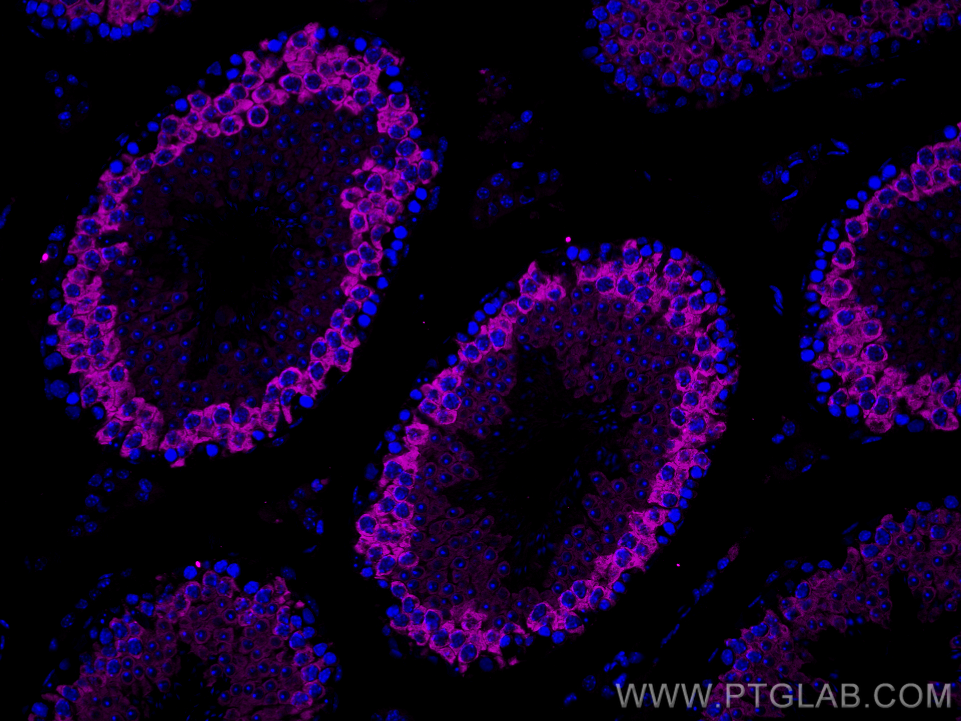 IF Staining of mouse testis using CL647-13720