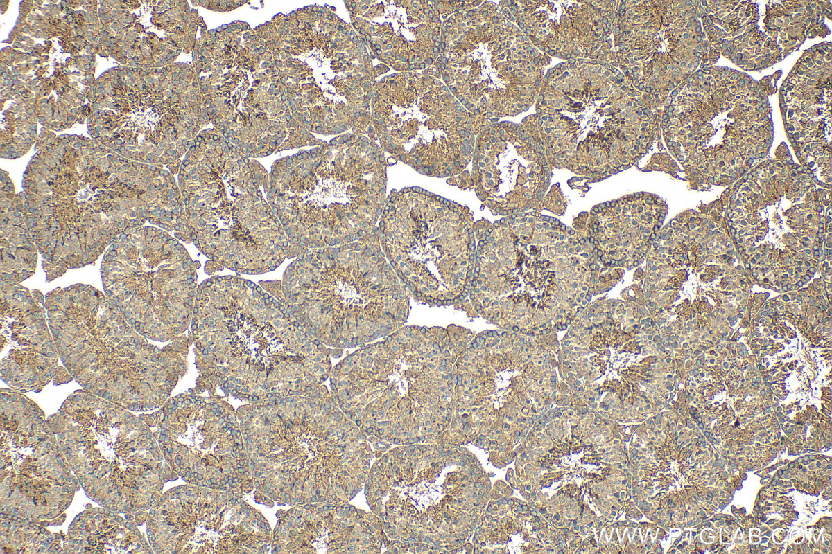 IHC staining of mouse testis using 27431-1-AP