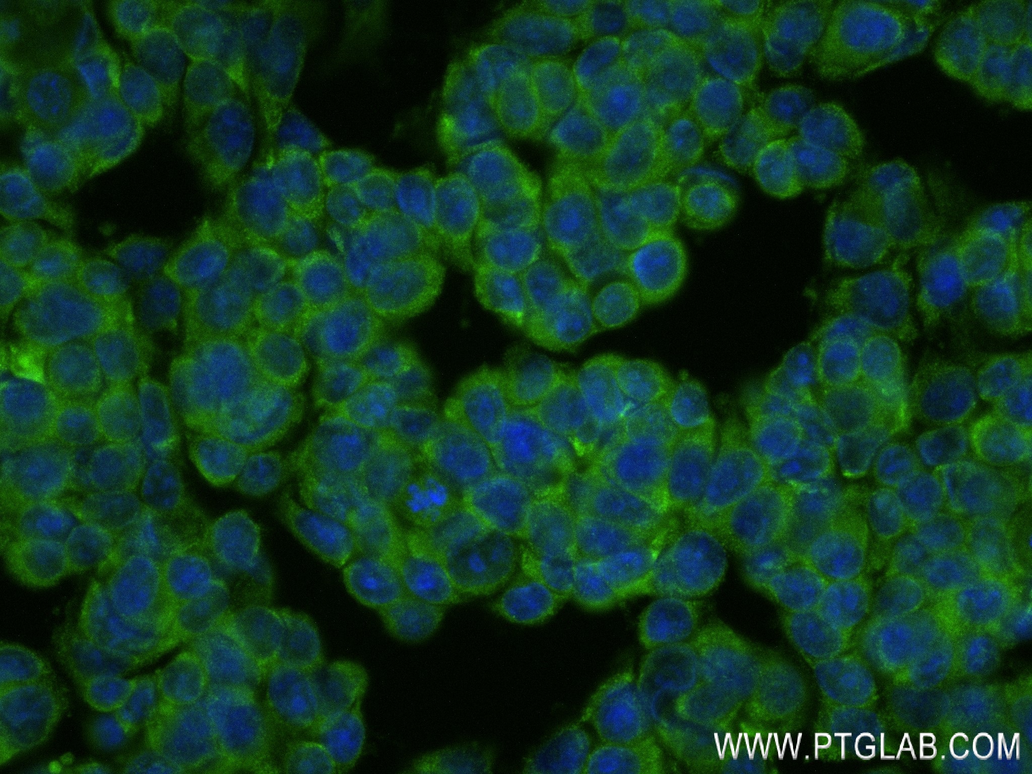 IF Staining of MCF-7 using 83314-6-RR