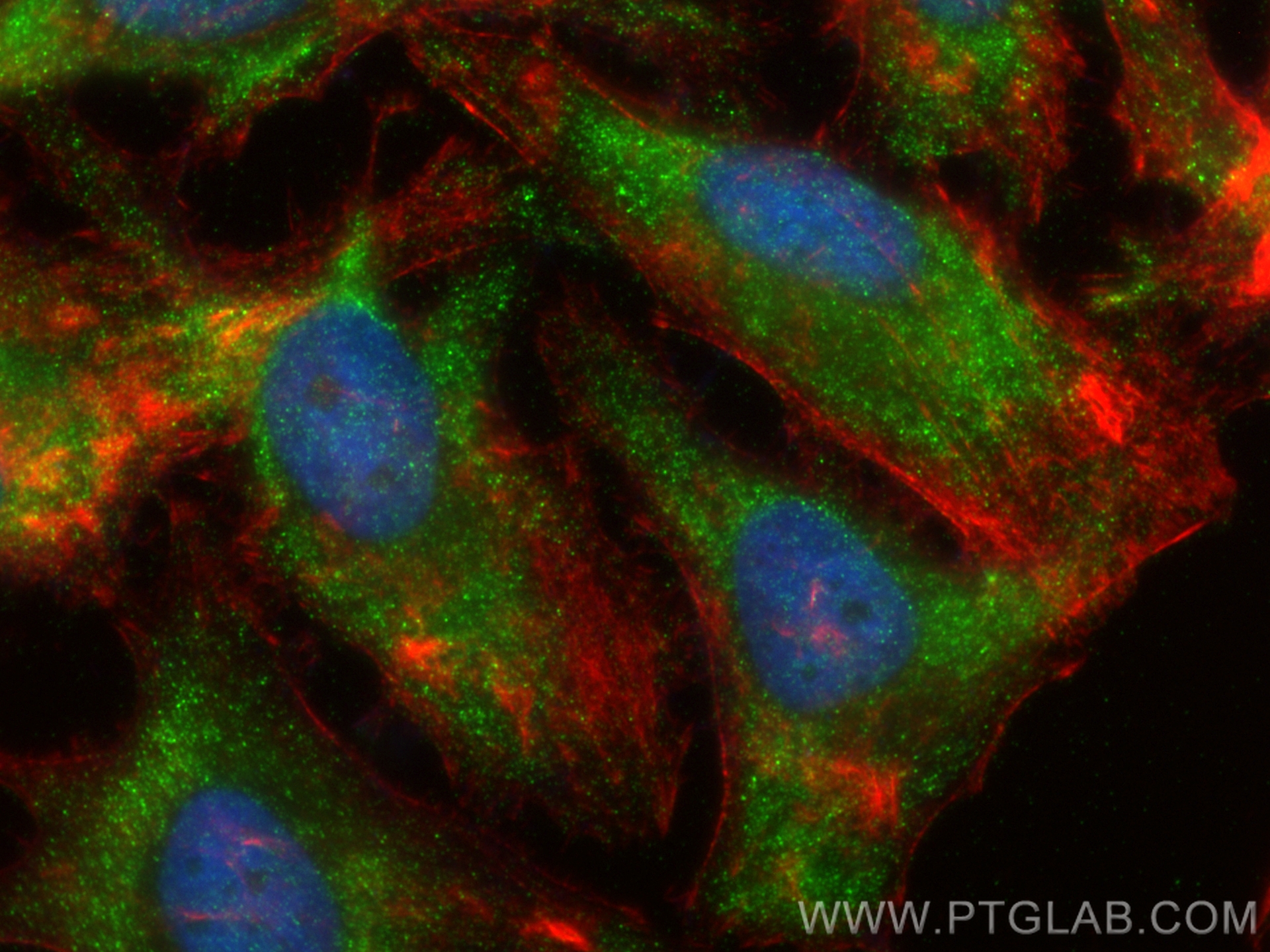 IF Staining of HeLa using 83314-6-RR (same clone as 83314-6-PBS)