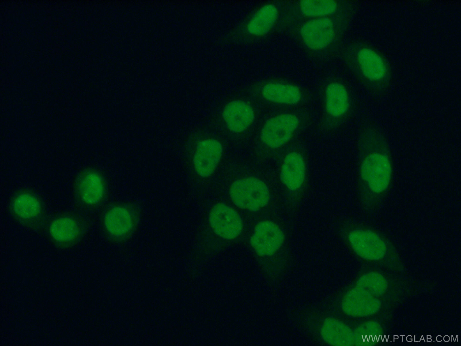 IF Staining of HeLa using 11859-1-AP