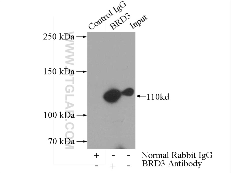 IP experiment of HeLa using 11859-1-AP