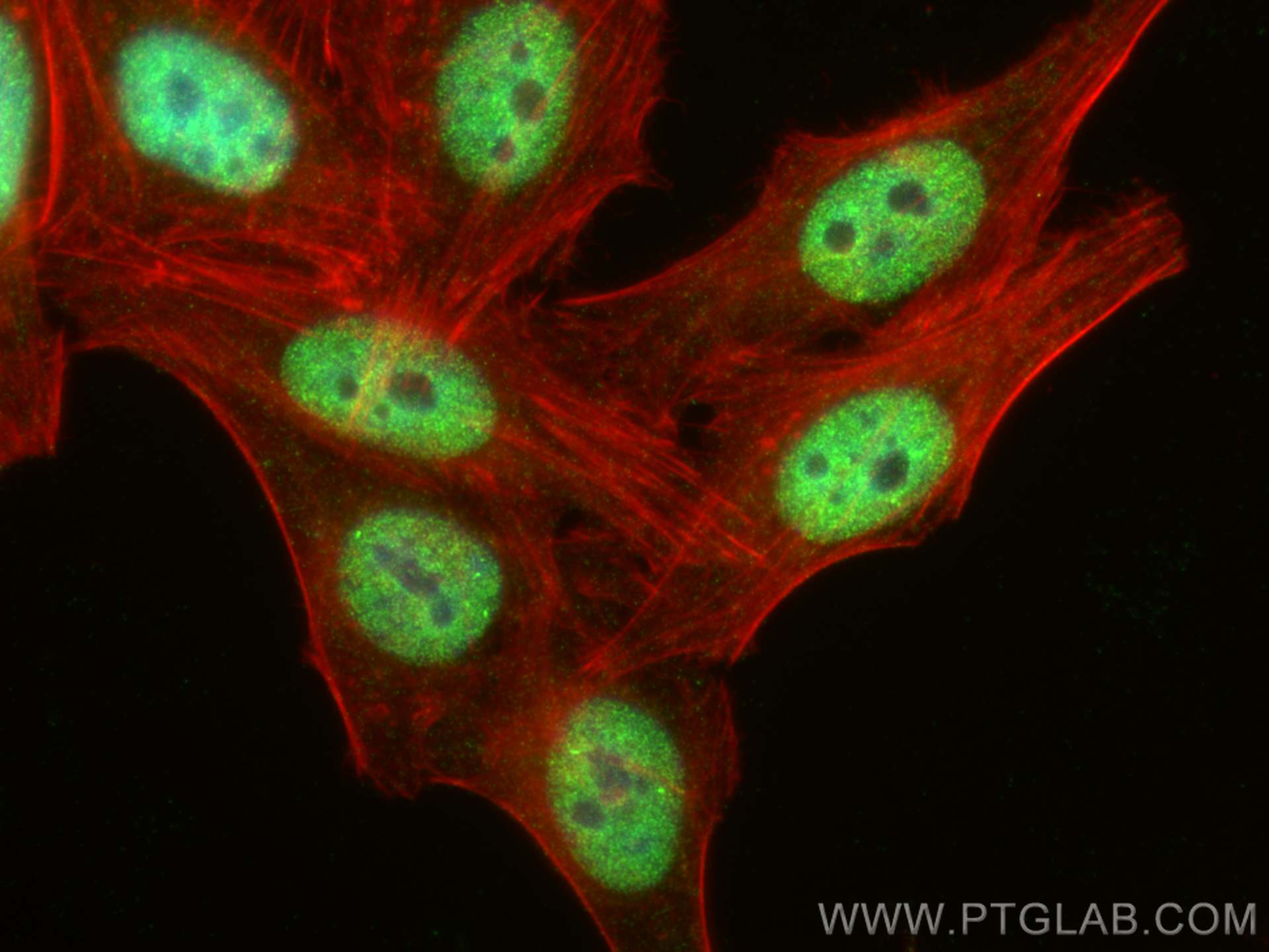 IF Staining of HepG2 using 28486-1-AP